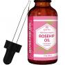 Rosehip Seed Oil by Leven Rose, 100% Pure Unrefined Cold Pressed Anti Aging Rose Hip Moisturizer for